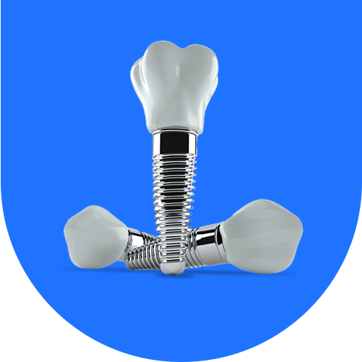 Implantes Dentários